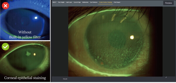 Щелевая лампа Dixion S 390 L (MediWorks).