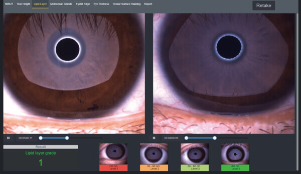 Щелевая лампа Dixion S 390 L (MediWorks).