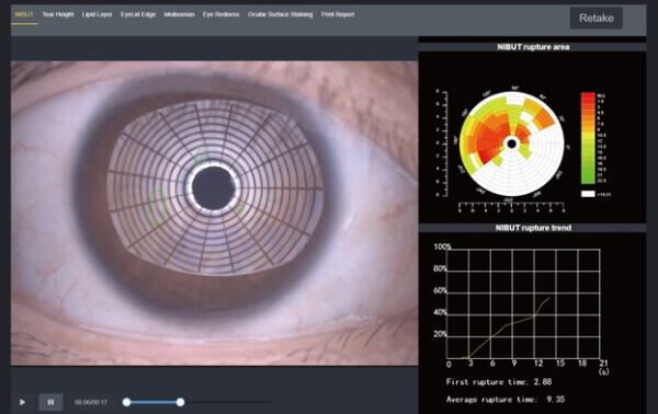 Щелевая лампа Dixion S 390 L (MediWorks).