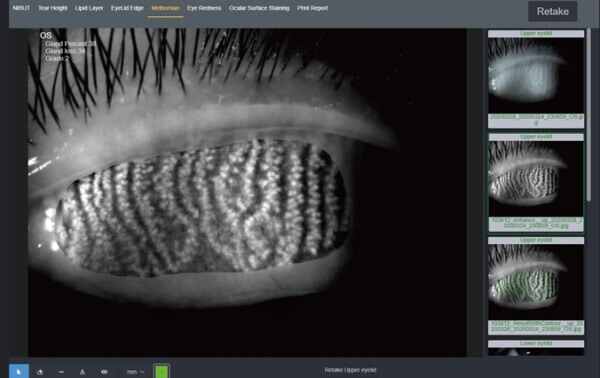 Щелевая лампа Dixion S 390 L (MediWorks).