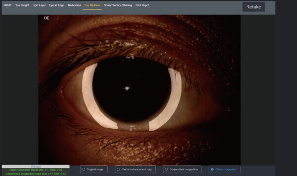 Щелевая лампа Dixion S 390 L (MediWorks).