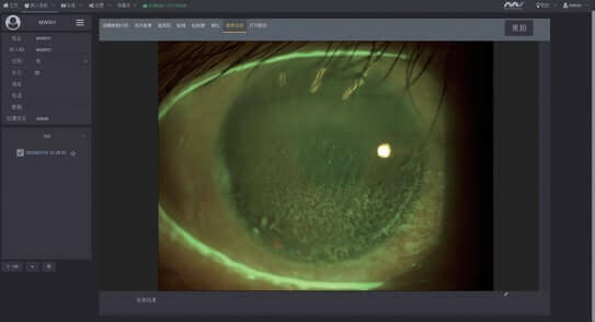 Щелевые лампы Dixion (MediWorks).