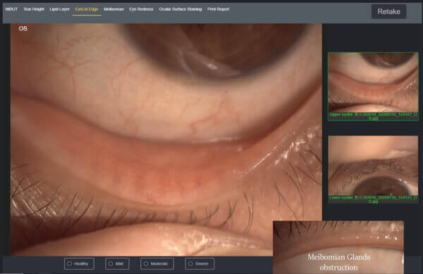 Щелевая лампа Dixion S 390 L (MediWorks).