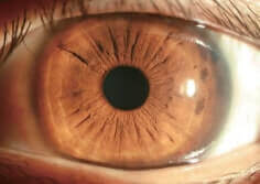 Щелевые лампы Dixion (MediWorks).