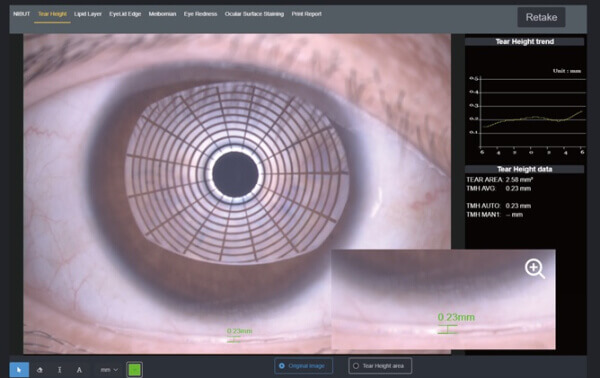 Щелевая лампа Dixion S 390 L (MediWorks).