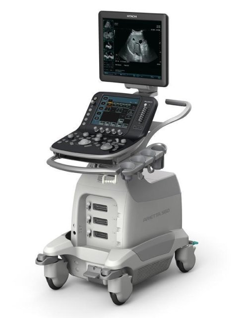 УЗИ аппарат Aloka ARIETTA S60 (Fujifilm (Hitachi)).