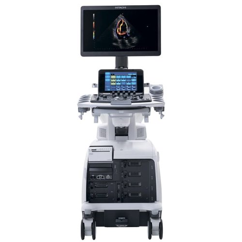 УЗИ аппарат Aloka ARIETTA S70 (Fujifilm (Hitachi)).