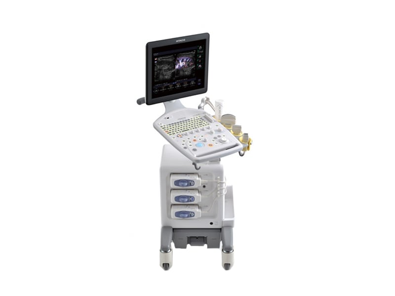 Ультразвуковой аппарат ProSound F31. (Fujifilm (Hitachi)).