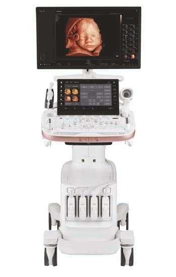 УЗИ сканер Z20 (Samsung).